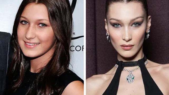 Artis-Artis Hollywood Ini Mukanya Beda Banget dari 10 Tahun Lalu