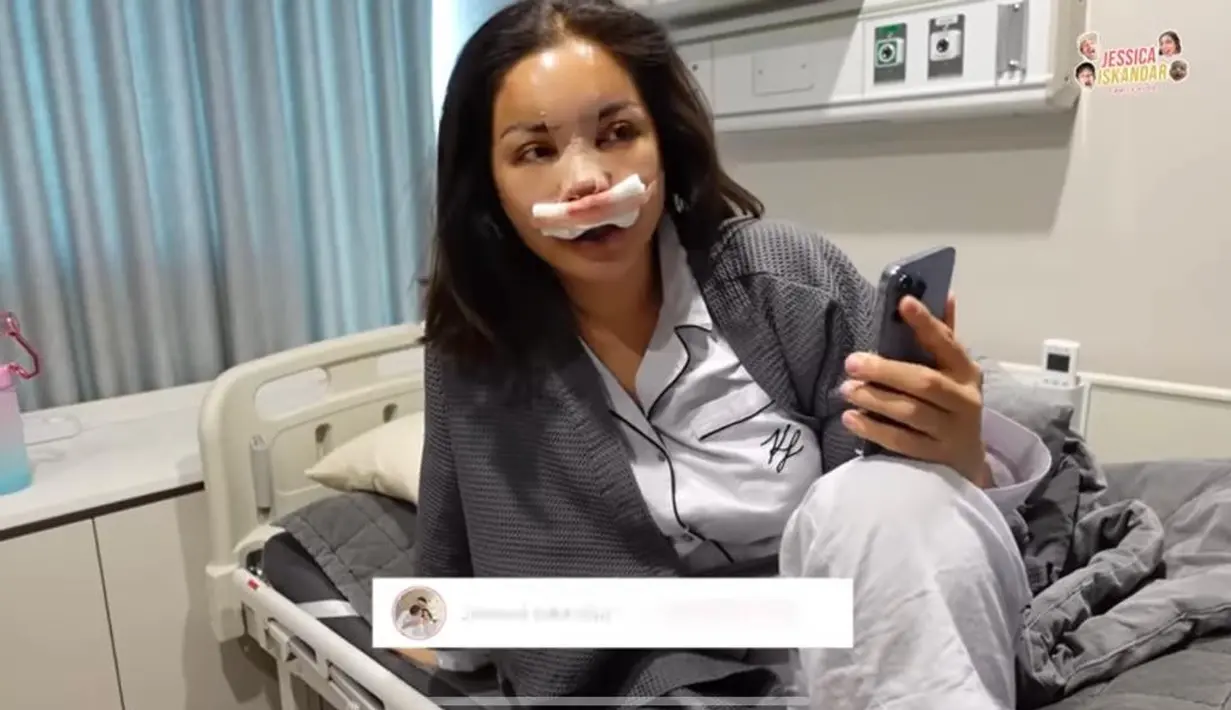 Ada dua jenis operasi hidung, yaitu Rhinoplasty dan septoplasty. [Foto: IG/inijedar].