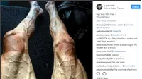 Viral, Kondisi Kaki Mengerikan Pembalap Sepeda Tour de France