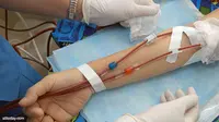 Anemia, Ketika Tubuh Tak Mampu Produksi Cukup Hemoglobin