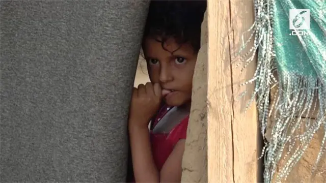 Akibat perang saudara, anak-anak Yaman terpaksa tinggal di kamp pengungsian. Kondisi mereka sangat memprihatinkan.