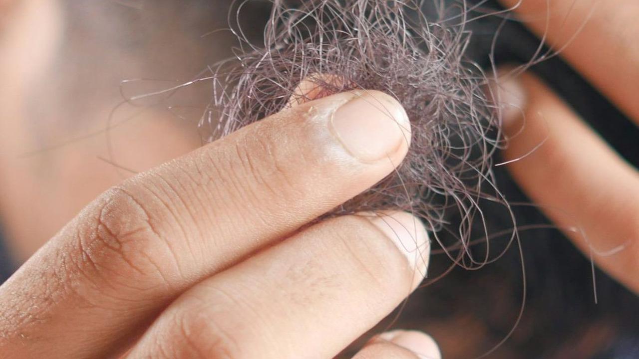 Bahan Alami untuk Menumbuhkan Rambut Botak