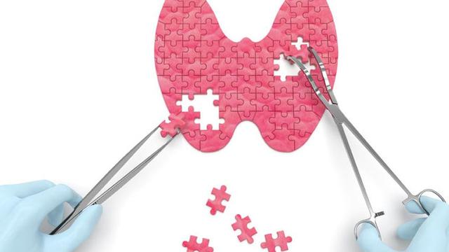 Dapatkah Kanker Tiroid Disembuhkan?