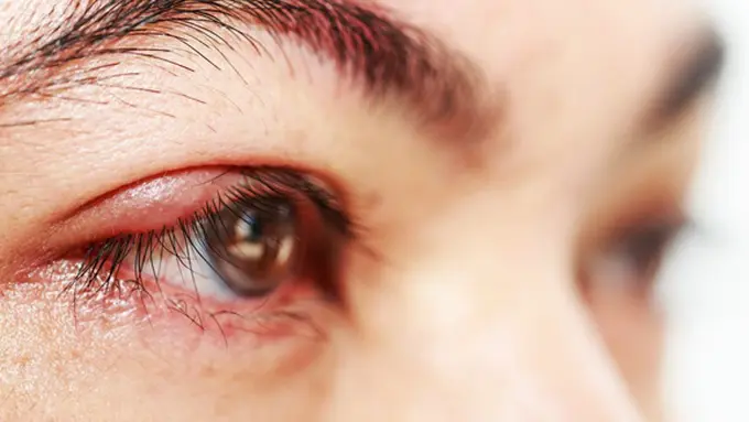 Foto: copyright thinkstockphotos.com