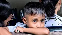 4 Tips Pilih Dokter Mata untuk Anak agar Terhindar dari Masalah Penglihatan. Foto: Liputan6.com/Ade Nasihudin.
