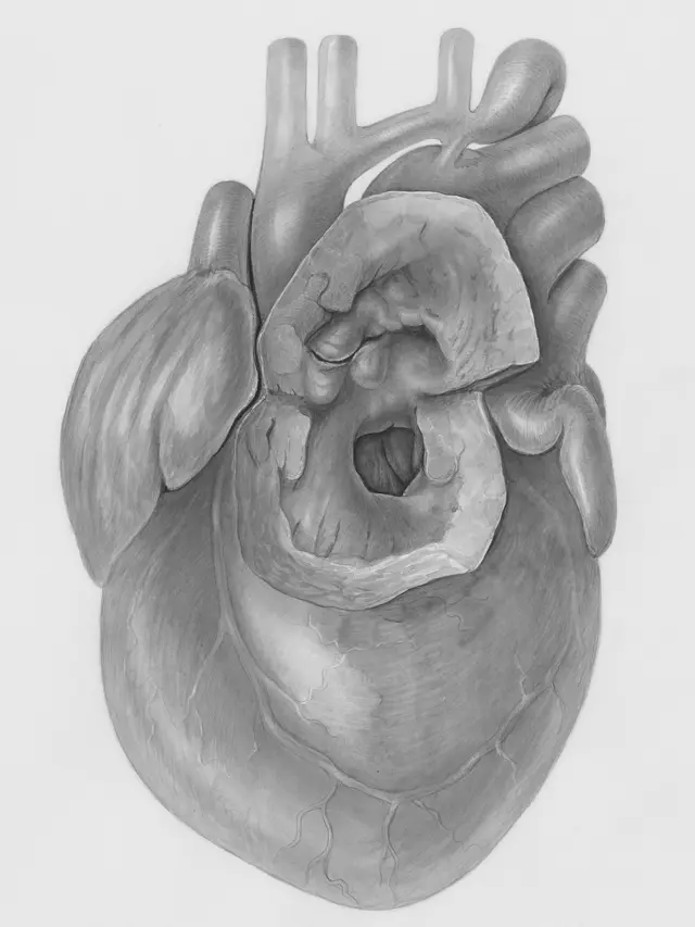 Heart