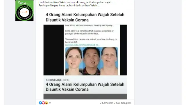 Cek Fakta Liputan6.com mendapati klaim foto orang mengalami kelumpuhan wajah setelah divaksin corona