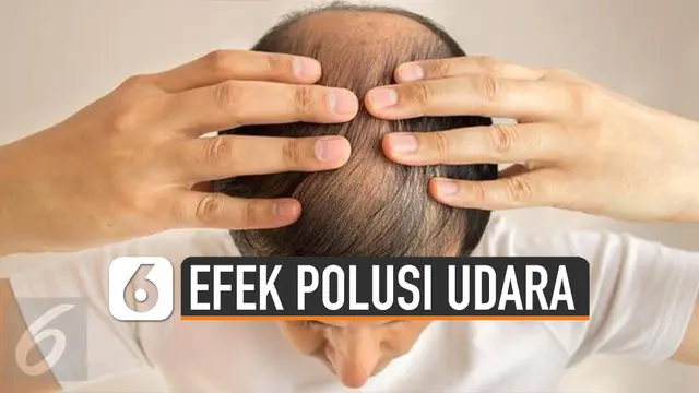 VIDEO: Fakta Baru, Polusi Udara Bikin Rambut Rontok