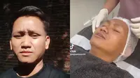 Pegi Setiawan Kini Jadi Seleb Tiktok, Glowing Berkat Perawatan (Sumber: Tiktok/pegisetiawan96)