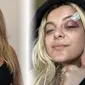 Bebe Rexha setelah accident