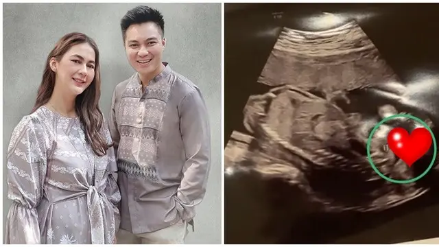 5 Momen Paula Verhoeven dan Baim Wong Ungkap Jenis Kelamin Anak Kedua