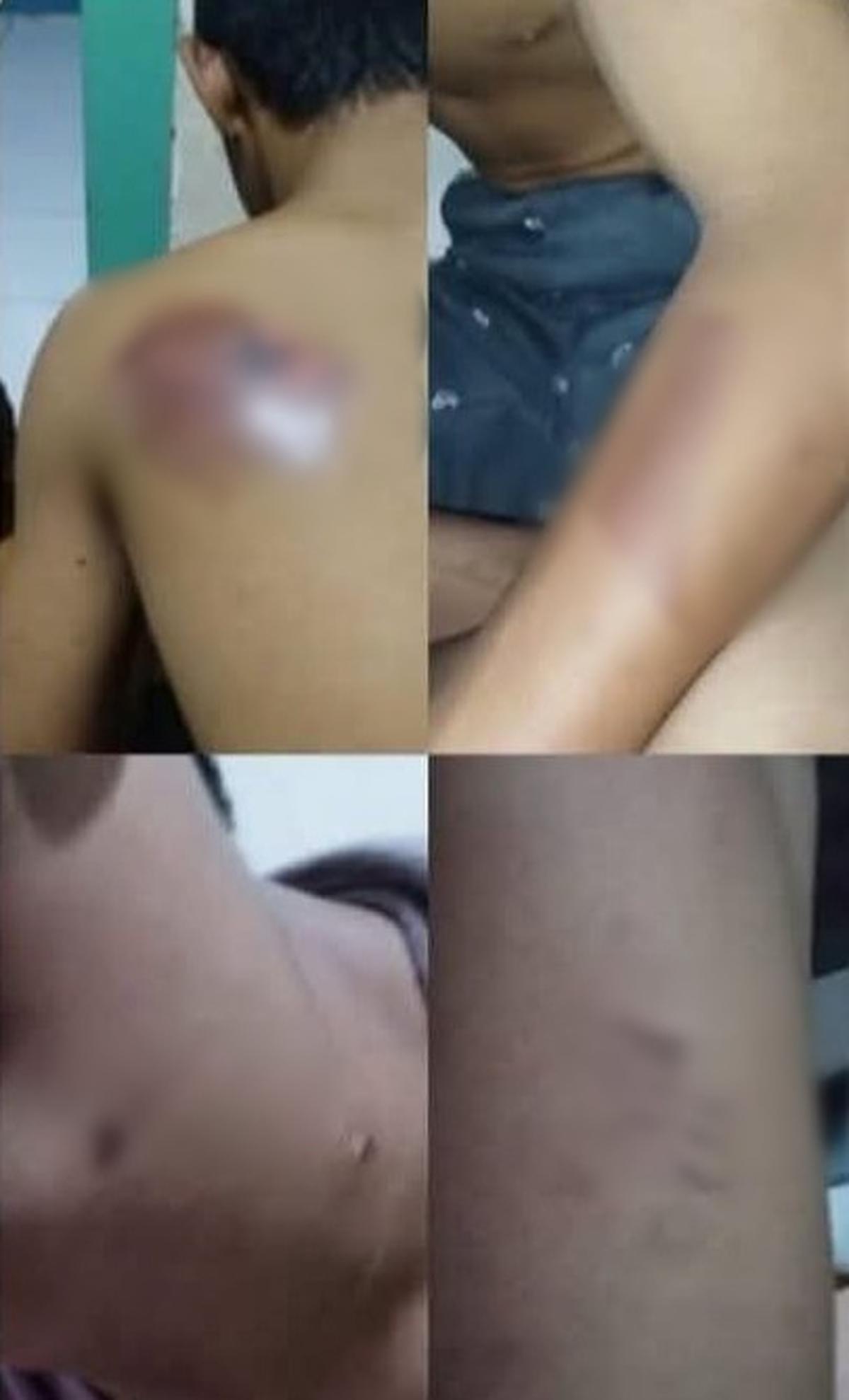 Santri difabel di gresik korban penganiayaan. (merdeka.com/istimewa).