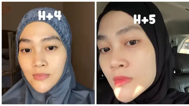 6 Potret Perubahan Wajah Henny Rahman Setelah Perawatan, Makin Cerah dan Mulus