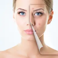 Punya masalah jerawat yang membandel atau bekas jerawat? Tenang, masker ampuh ini bisa mengatasi semua masalah kamu dalam sekejap.
