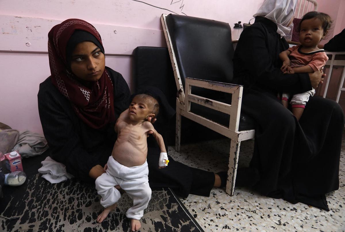 FOTO: Tubuh Kecil yang Lapar, Potret Pedih Bayi Gaza di Tengah Ancaman Kelaparan Massal