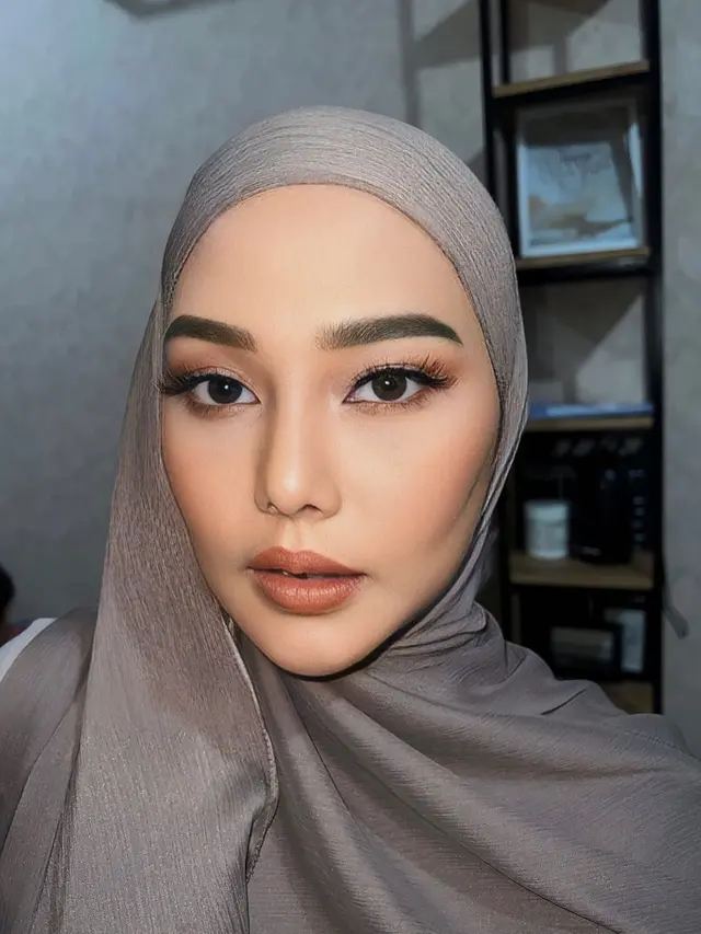 Foto Dara Arafah Dikira Netizen Oplas Dagu