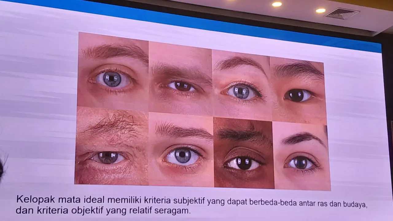 Preferensi kelopak mata pada acara media session bersama JEC Eye Hospitals & Clinics.