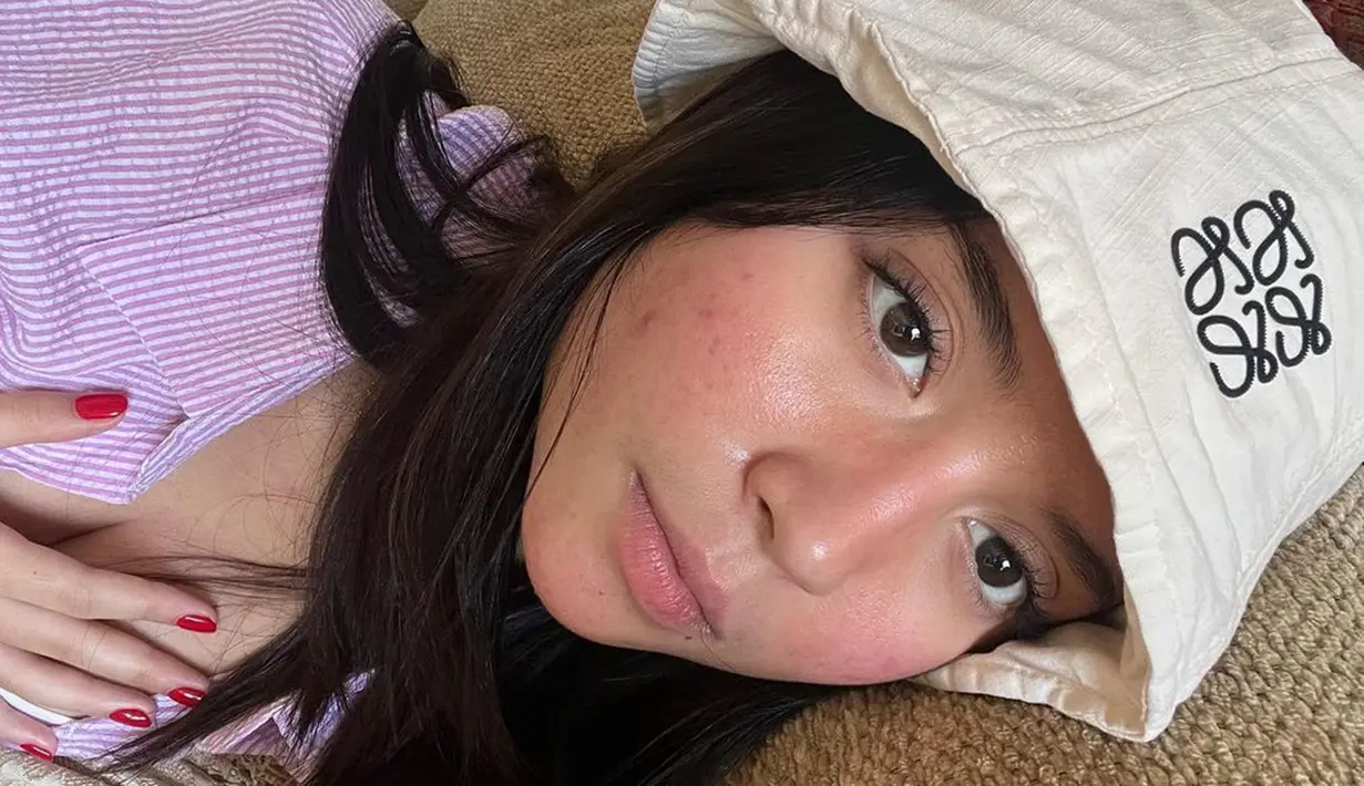 Meski pamer wajah berjerawat, wajah artis kelahiran 6 Juni 2004 ini dipuji sehat oleh warganet. Bahkan tak sedikit yang memuji Asha Assuncao lebih cantik ketika tampil tanpa makeup. Agar wajahnya tetap sehat, Asha tentunya rutin menjalani perawatan. Unggah foto tanpa pamer senyuman, lawan main Zoe Abbas Jackson di sinetron BHSI ini tetap pancarkan pesona. (Liputan6.com/IG/@asha.assuncao)
