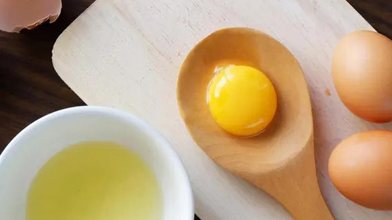 Waspadai! ini Daftar Lengkap Makanan Pemicu Kolesterol yang Harus Dihindari