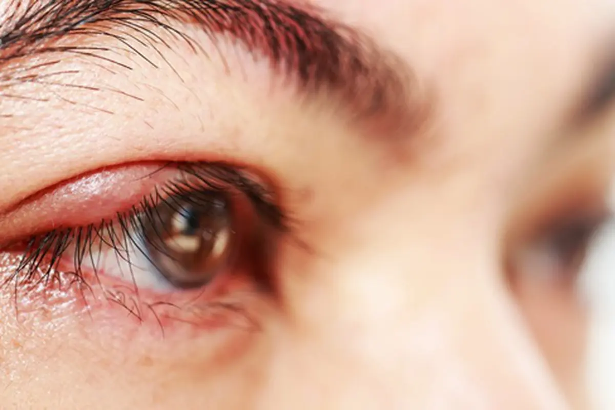 Foto: copyright thinkstockphotos.com