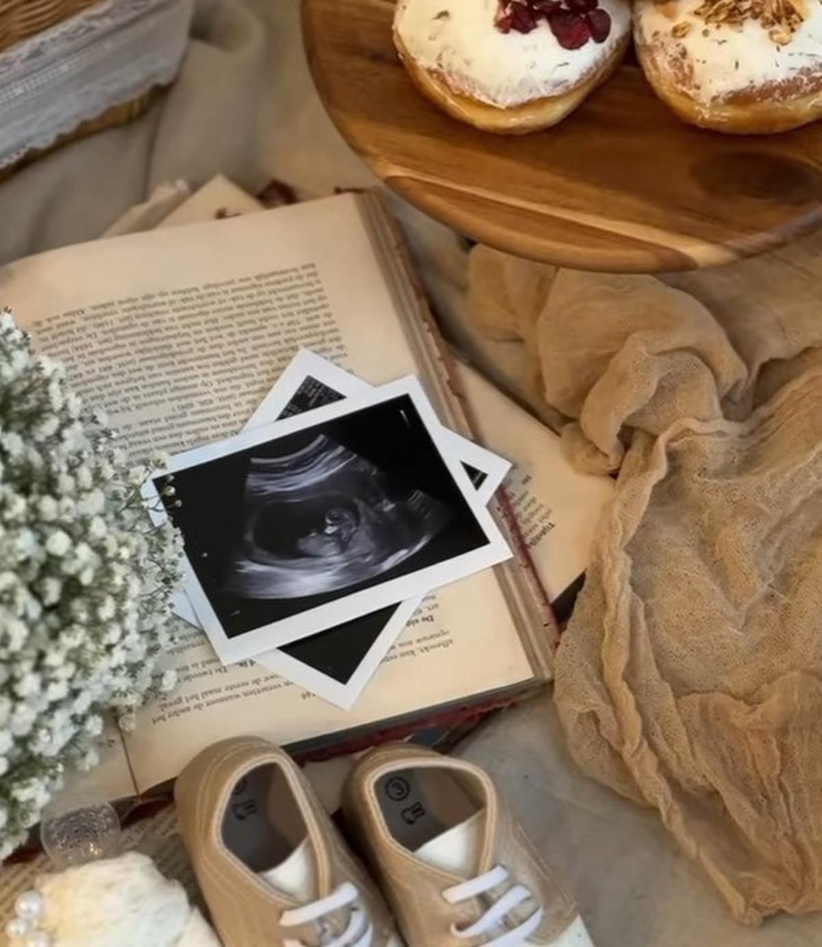 Perjuangan Aaliyah di Kehamilan 4 Bulan, Thariq Halilintar Ungkap Keram hingga Nyeri yang Dihadapi Istri