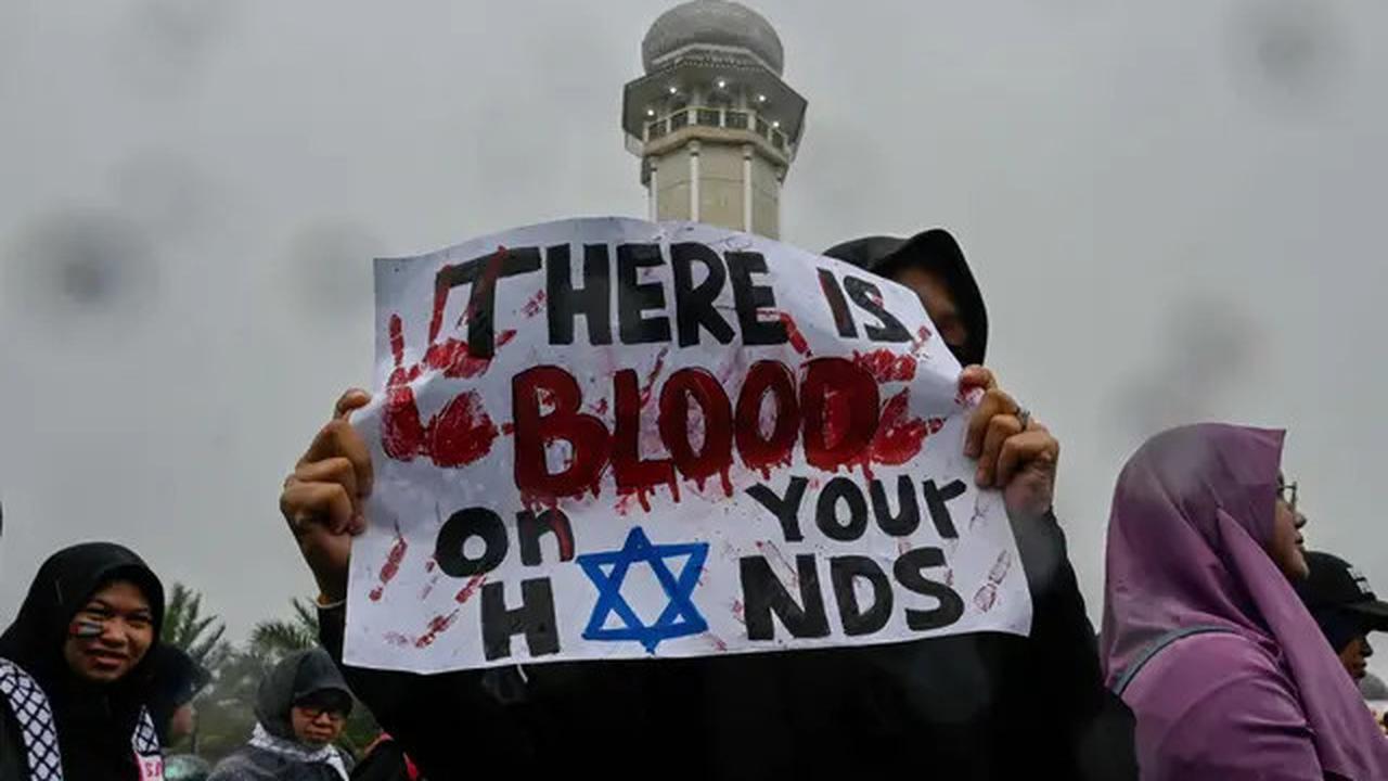 Startup Pakistan Kirim Kaki Prostetik untuk Anak Gaza Korban Serangan Israel
