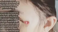 Viral Penganiayaan Siswi di Tasikmalaya, Terduga Pelaku Ternyata Bukan Anak Pejabat Kementerian