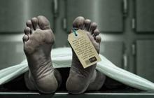 Pria Meregang Nyawa di Kamar Hotel Usai Tenggak Obat Kuat