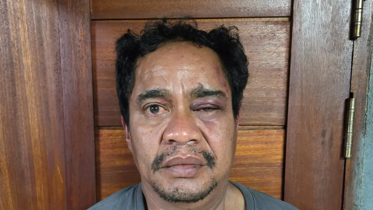 Bandar Narkoba Jaringan Ko Erwin Ditangkap