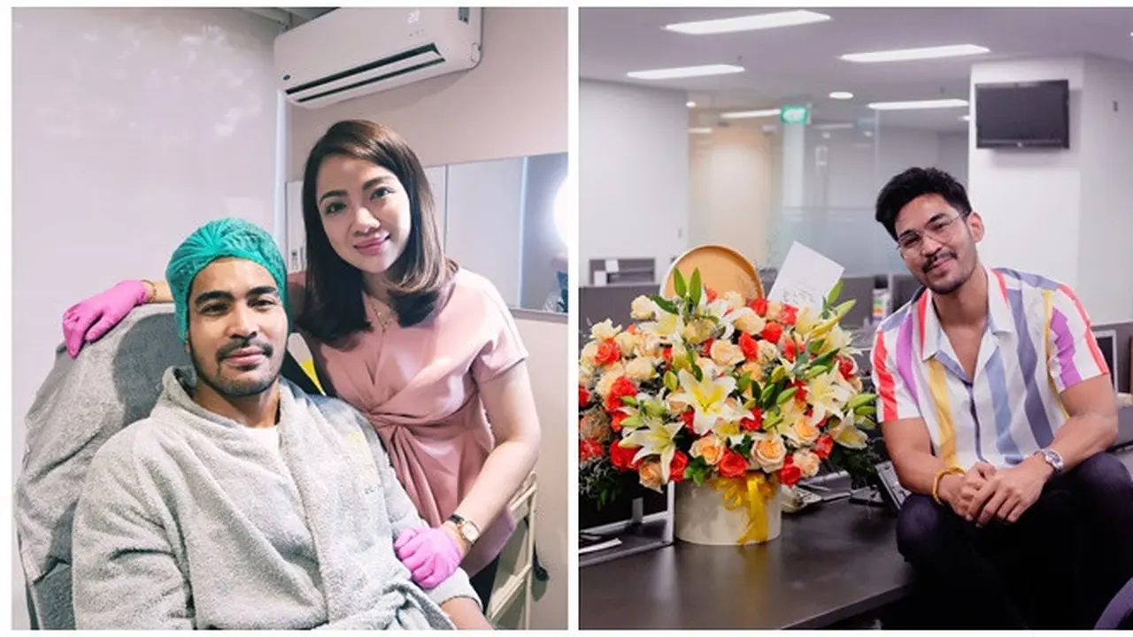 Jalani Suntik Botoks, Ini 7 Potret Terbaru Robby Purba