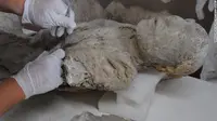 'Manusia Batu' Pompeii Ternyata Punya Gigi Bagus, Rahasianya? 