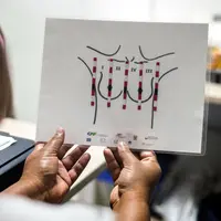 Pasien melihat sebuah diagram pemeriksaan payudara yang akan dilakukan petugas medis tunanetra di sebuah rumah sakit di Cali, Kolombia (14/11). (AFP/Luis Robayo)