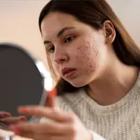Wanita yang sedang bercermin melihat kondisi wajahnya (Foto: Freepik/freepik).