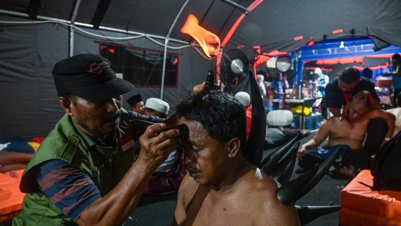 FOTO: Terapi Bekam Tanduk Sapi, Pilihan Lawas di Zaman Modern