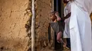 Petugas kesehatan menimbang berat badan seorang anak saat program pencegahan kurang gizi di Pusat kesehatan di Mbau, Republik Demokratik Kongo (15/11). Di negara ini banyak penduduknya menderita kekurangan gizi. (AFP/ Eduardo Soteras)