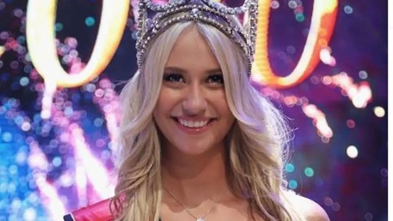 Miss Belgia 2020 Celine Van Ouytsel yang Sempat Terjatuh di Panggung