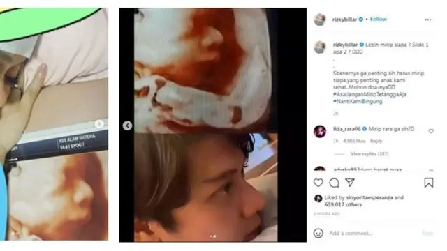 Foto USG kehamilan Lesti Kejora yang diunggah Rizky Billar