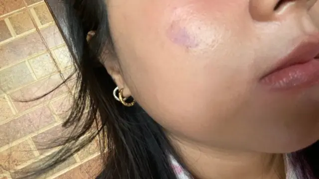 Netizen Korban Tinta Pemilu