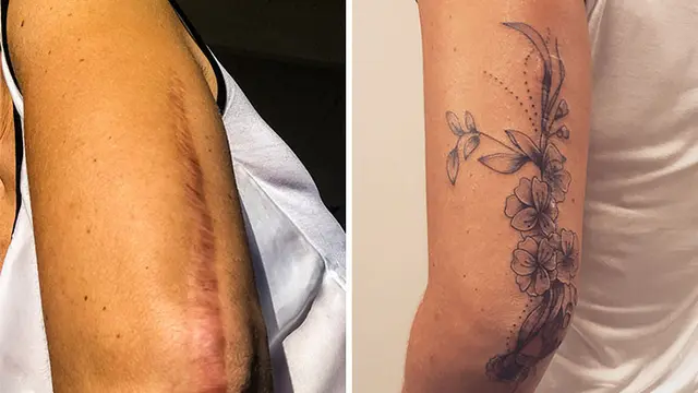 tato dari bekas luka (foto: boredpanda)