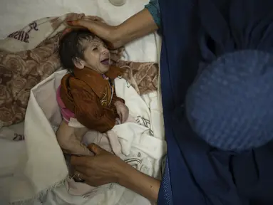 Sofia menggendong bayinya, Abdul (2 bulan), saat menjalani perawatan di bangsal gizi buruk Rumah Sakit Anak Indira Gandhi di Kabul, Selasa (5/10/2021). Petugas kesehatan di rumah sakit itu berlari mondar-mandir merawat bayi prematur dan yang lainnya menderita kekurangan gizi parah. (AP/Felipe Dana)