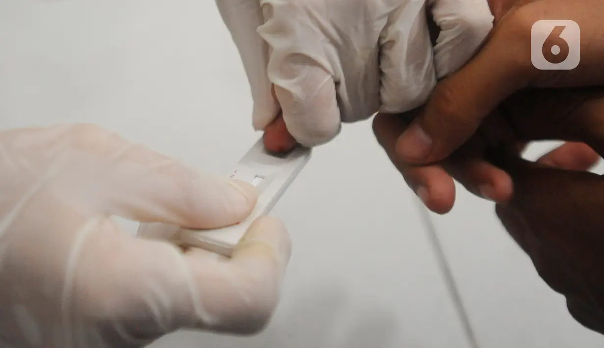 Dengan berbekal pengetahuan yang baik, VCT tidak hanya mampu mencegah penularan HIV/AIDS, juga mampu mengurangi stigma dan diskriminasi terhadap ODHA. (merdeka.com/Arie Basuki)
