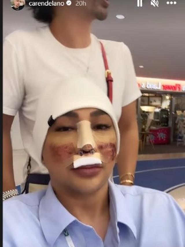 Potret Caren Delano Jalan-Jalan di Korea Usai Oplas, Wajah Masih Diperban