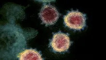 Gambar ilustrasi ini dengan izin dari National Institutes of Health pada 27 Februari 2020. Menunjukkan mikroskopis elektron transmisi SARS-CoV-2 juga dikenal sebagai 2019-nCoV, virus yang menyebabkan Corona COVID-19. (AFP/National Institutes of Health).