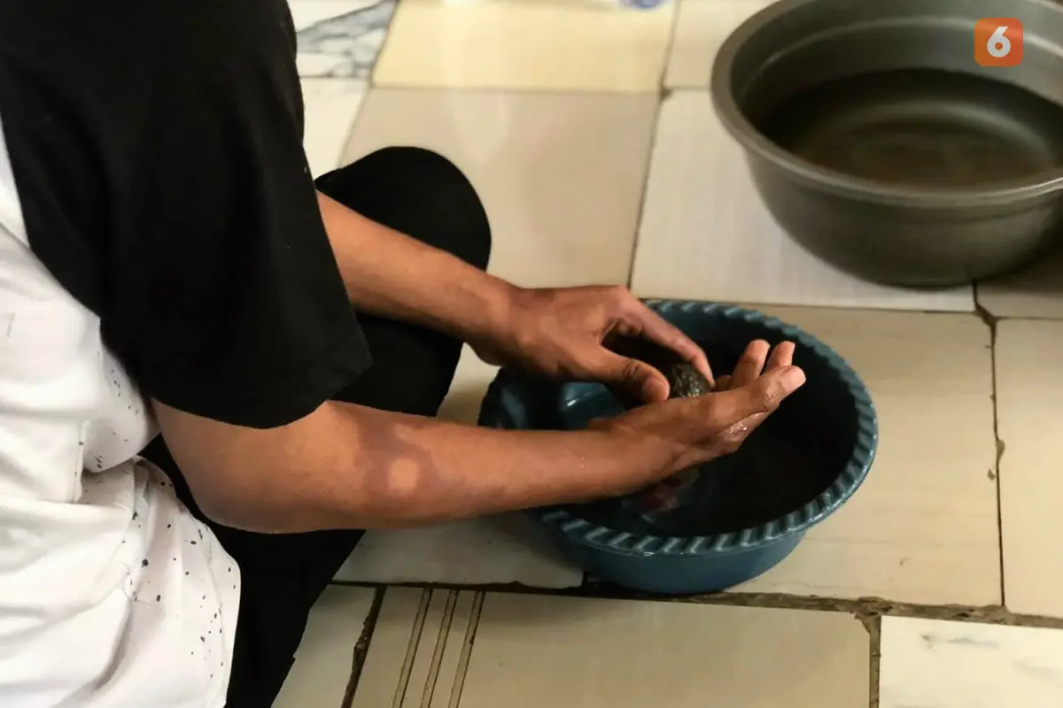 Kusta Dianggap Penyakit Kuno, Dokter: Padahal Indonesia Duduki Peringkat Tiga dengan Jumlah Kasus Tertinggi