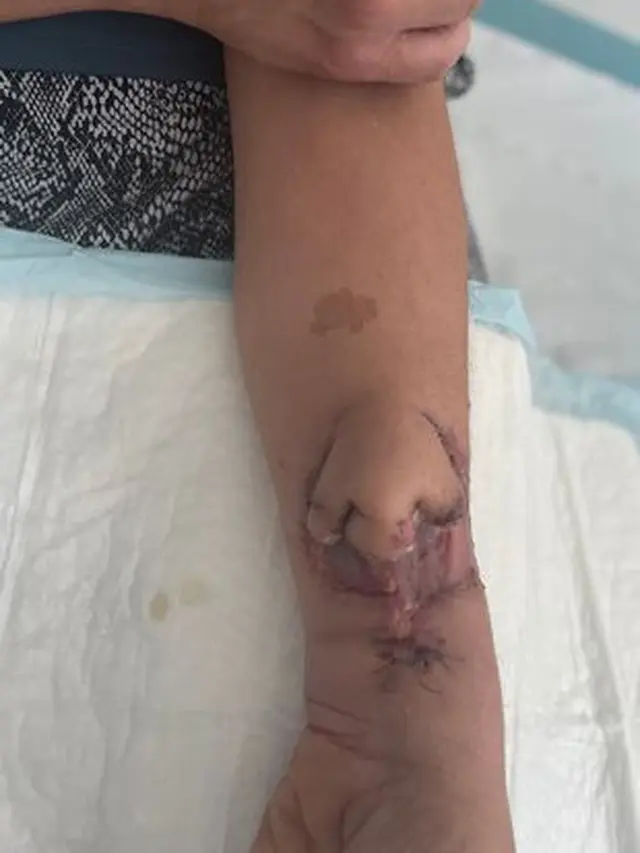 Wanita Punya Hidung diTangan