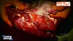 liputan6
