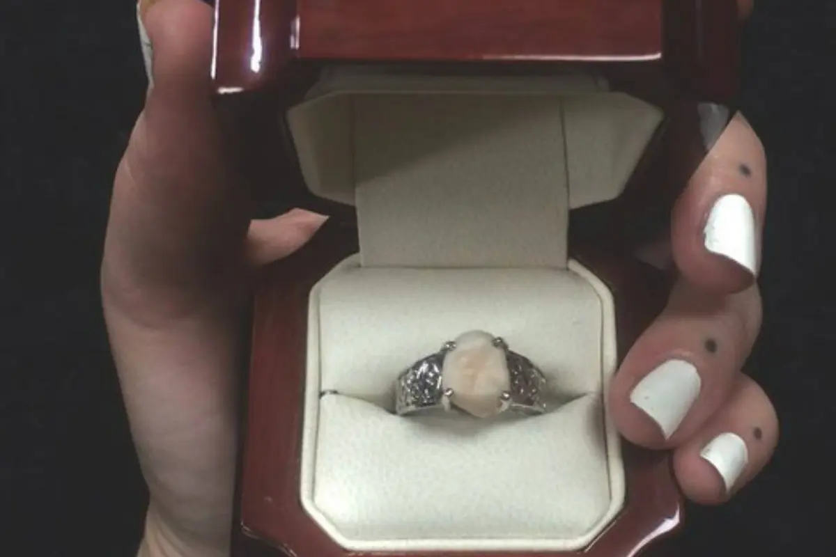 Cincin Tunangan Wanita Ini Terbuat dari Gigi Calon Suami