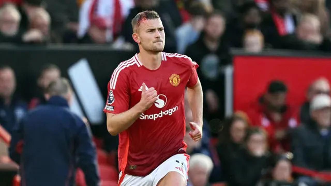 Ruben Amorim Tegaskan Fokus Penuh MU ke Liga Europa: Laga Terpenting!