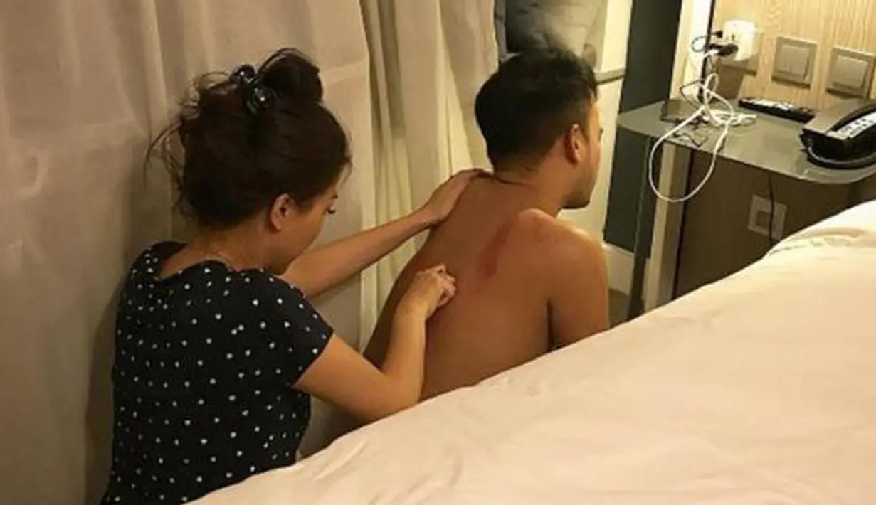 Tidak hanya saat di Jakarta, begitu juga saat beberapa tahun lalu sedang berlibur ke luar negeri. Ruben juga di kerok oleh istrinya. (Instagram/ruben_onsu)