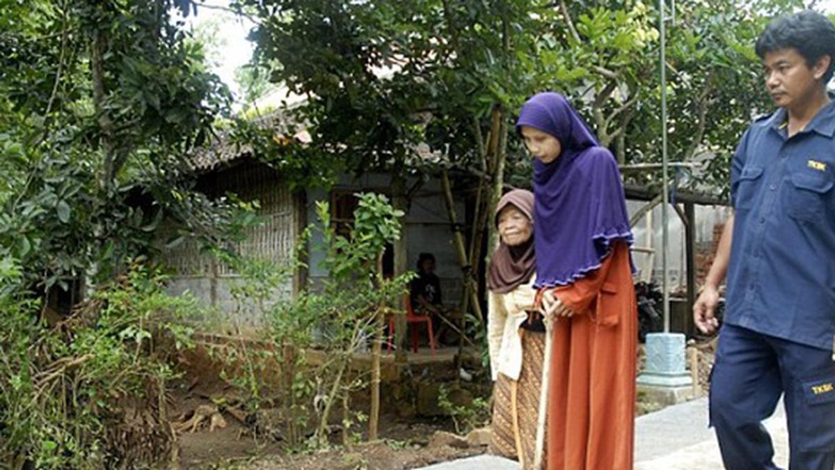 Derita Kondisi Langka, Tubuh Sulami Kaku Seperti Papan Kayu